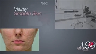 هیدرودرم ابریژن در مقابل میکرودرم ابریژن کدام بهتر است؟ جراحی زیبایی پلک