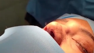 فیلم واقعی و بدون سانسور جراحی زیبایی بینی