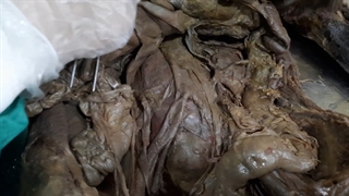 جسد. سیستم ادراری 1 پزشکی