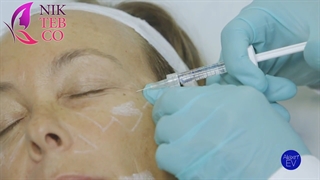 آموزش تزریق انواع ژل الیاکسین برای پزشکان