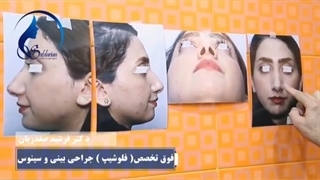 جراحی بینی استخوانی در اتاق عمل