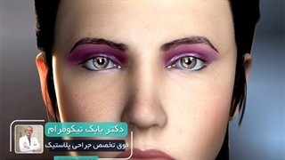 جراحی زیبایی پلک