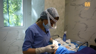 فیلم کاشت ابرو کلینیک مهرزاد