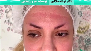 کاشت ابرو و تاثیر زیادش بر زیبایی چشم ها