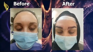 نظرتون راجع به این کاشت ابرو چیه؟