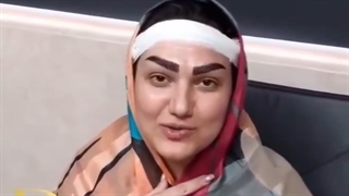 مصاحبه با زیباجوی کاشت ابرو