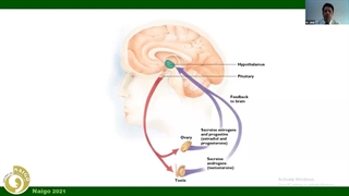 درمان طبی در آندومتریوز با GnRH آگونیست ها - دکتر امیرمنصور جلالی