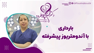 موضوع: بارداری با آندومتریوز پیشرفته بخش اول