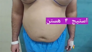 فیلم عمل ژنیکوماستی