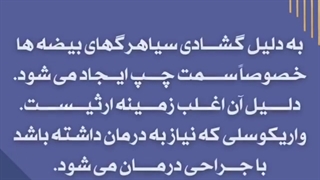 درمان قطعی واریکوسل