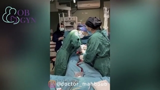 فیلم واقعی زایمان سزارین در اتاق عمل
