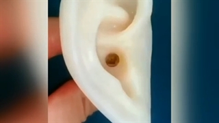 گوش پاک کن فلزی