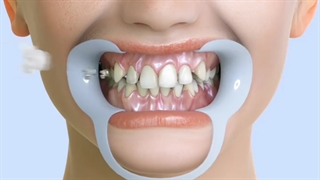 تاثیر ارتودنسی بر دندان.متخصص ارتودنسی دکتر علیرضا خدیوی