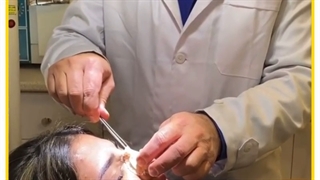 رضایت از عمل بینی