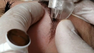 نانو بروز ابرو چگونه انجام می شود؟