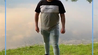 تصاویر قبل و بعد از عمل چاقی