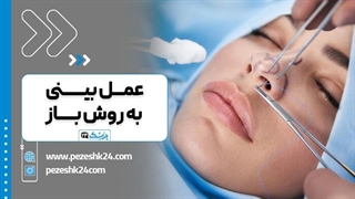 انیمیشن فیلم عمل بینی به روش باز (فیلم تکنیک باز عمل بینی)