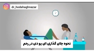 نحوه جای گذاری ای یو دی