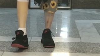 پروتز پا (پای مصنوعی) سایم - پروتز برای قطع عضو از مچ پا | کلینیک ارتوپدی فنی آسه