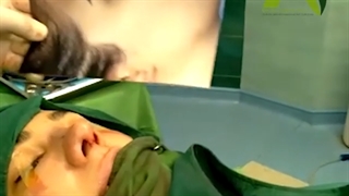 جراحی زیبایی بینی