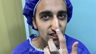 جراحی زیبایی بینی در آقایان