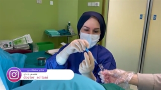 انتقال جنین 2 مرحله ای