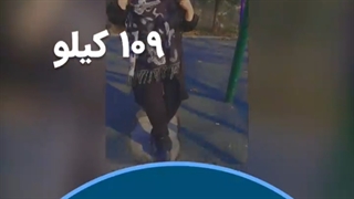 تصاویر قبل و بعد از عمل چاقی