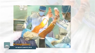 تعویض مفصل همزمان دو زانو