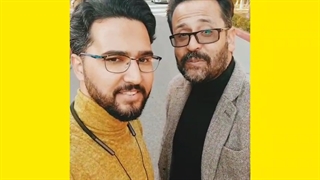 چال روی گونه لیپوماتیک