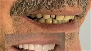 8 واحد لمینیت سرامیکی ایمکس