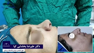 جراحی زیبایی بینی