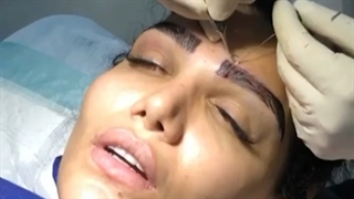 مراحل کاشت ابرو