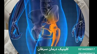 رادیوتراپی سرطان استخوان