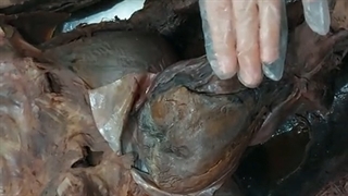 عملی قلب و عروق 3.پزشکی