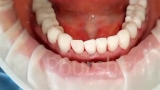 رضایت و محبت مراجعه کننده مرکز دندانپزشکی دکتر پورشاهی