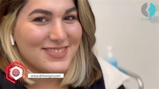 جراحی بینی طبیعی زنانه