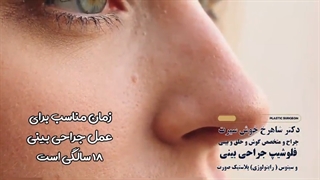 سن مناسب جراحی بینی