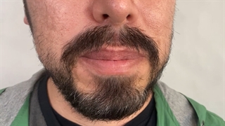 بهترین ایمپلنت دندان (دکتر بهمن پوراقدم)02122220000