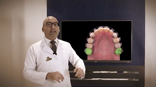 ایمپلنت و ارتودنسی | دکتر داودیان