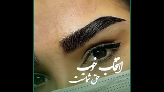 بهترین مرکز کاشت ابرو در تهران