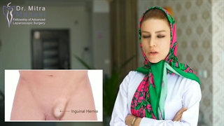 فتق کشاله ران به چه صورت جراحی کنیم؟