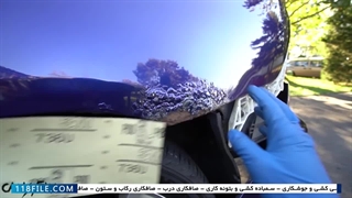 ترمیم پوسیدگی گلگیر