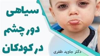 سیاهی دور چشم در کودکان چه علتی دارد؟