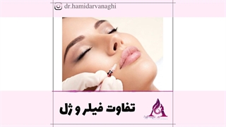 تفاوت ژل و فیلر