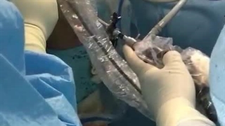 ترمیم رباط صلیبی