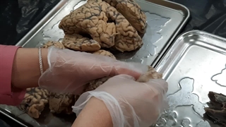 عملی غدد 3. پزشکی