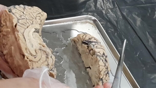 عملی غدد 4. پزشکی