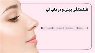 شکستگی بینی، علائم و راه های درمان آن