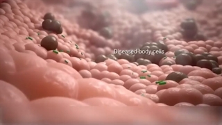 واکسن گارداسیل
