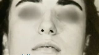 نمونه کار جراحی بینید کتر احمد دانشی